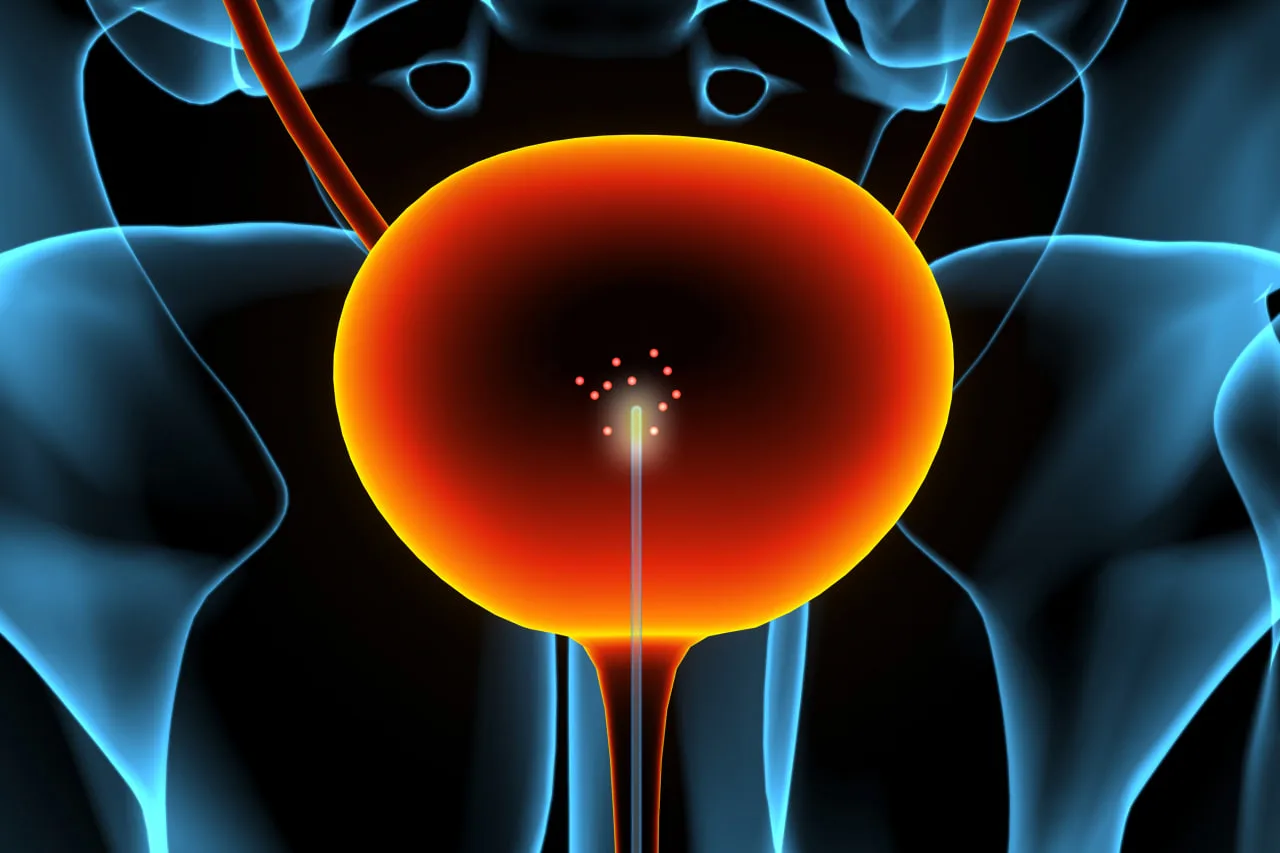 bladder-cancer.jpg