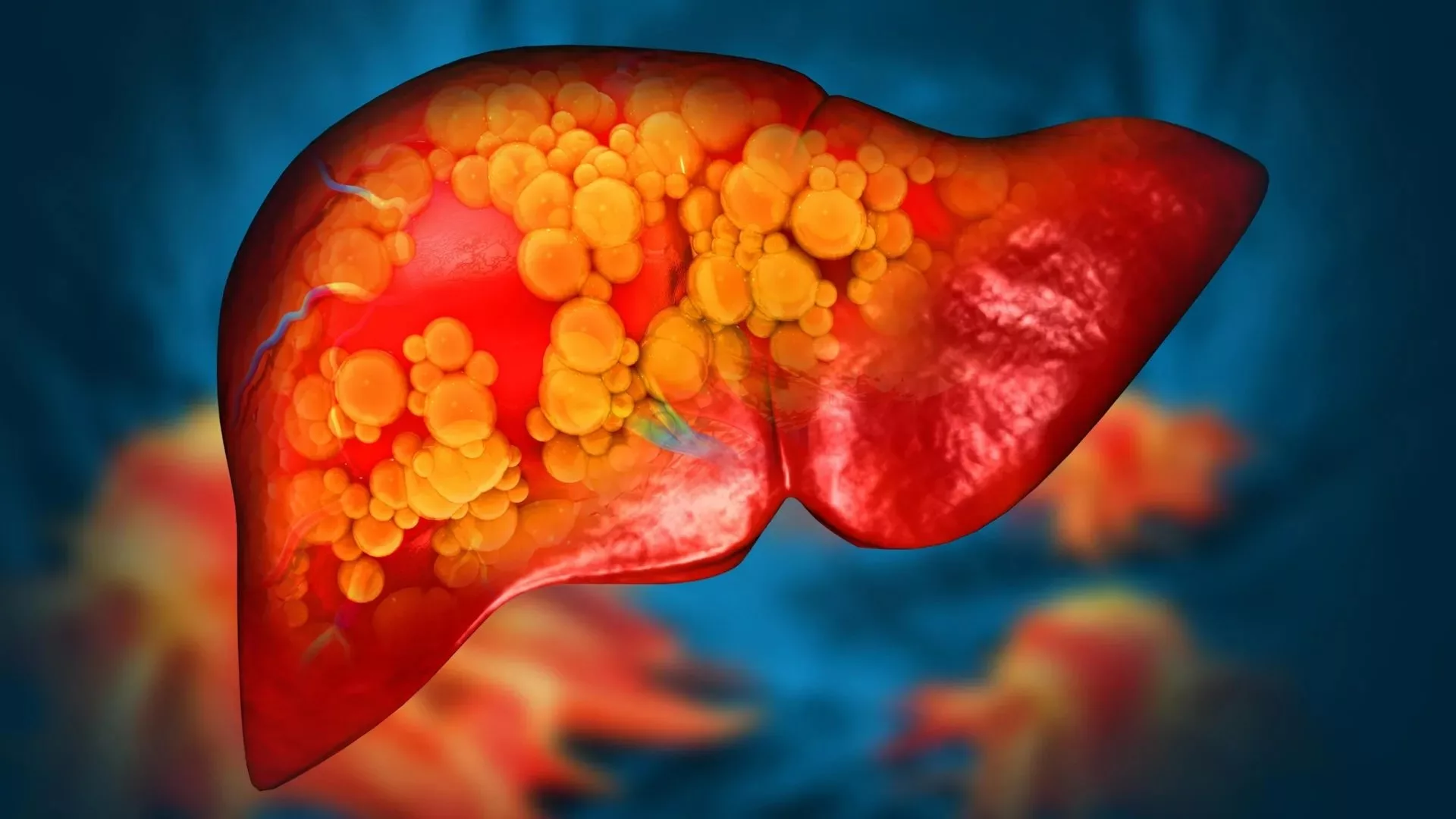 polyethylene-microplastics-fatty-liver-disease-study-۲.jpeg