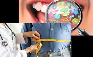میکروب های دهان می‌توانند کلید پیشگیری از چاقی باشند