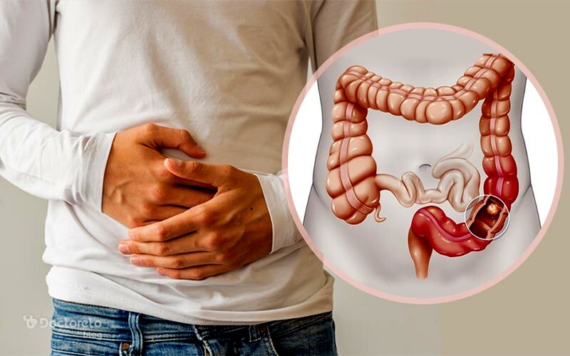 آیا نگه داشتن مدفوع، مضر است؟ 