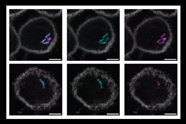 ابتکار دانشمندان «امآیتی» در شناسایی آسان کشندهترین باکتری جهان
