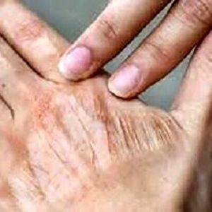 اقدام ساده برای رفع خشکی پوست