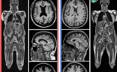 مغز جوان‌تر می‌خواهید؟ این توصیه‌ها را رعایت کنید 