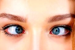 آیا لوچ کردن چشم‌ها از روی عمد واقعاً خطرناک است؟ 