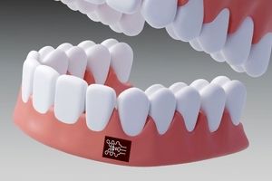 تشخیص التهاب لثه فقط با یک برچسب