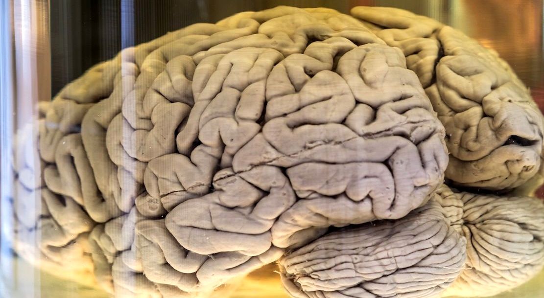 چین‌ خوردگی‌های مغز «شناخت» را عمیق‌تر می‌کنند