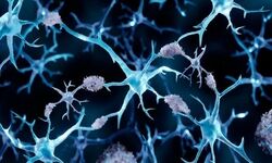 کشف راهی جدید برای مقابله با آلزایمر 