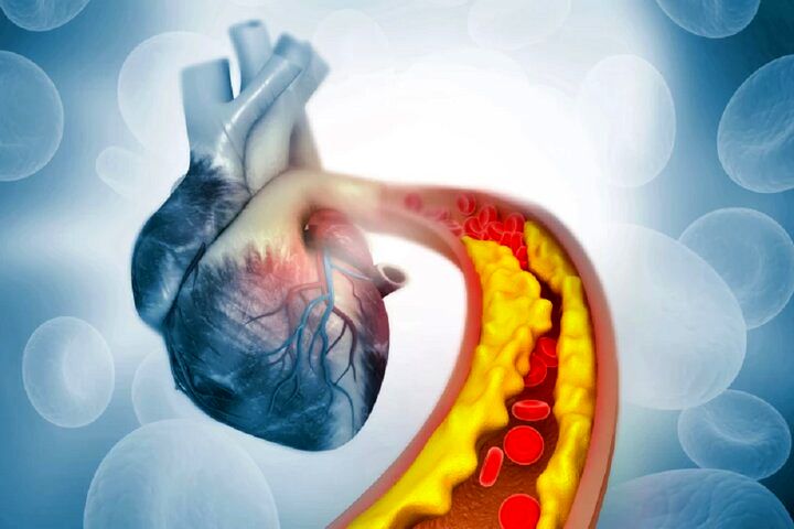 کاهش چربی خون با کمک ویرایش ژن برای اولین بار