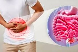 با این روش‌ های طبیعی از شر یبوست زمستانی خلاص شوید