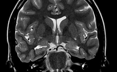 سلول‌های مغزی انسان سریع‌تر از هوش مصنوعی یاد می‌گیرند