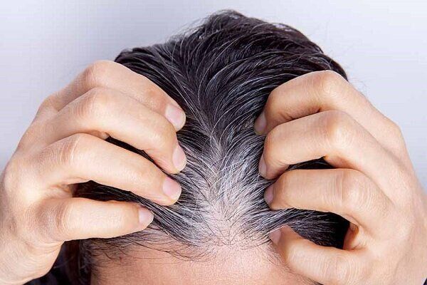 یافته‌ای جدید درباره سفید شدن مو