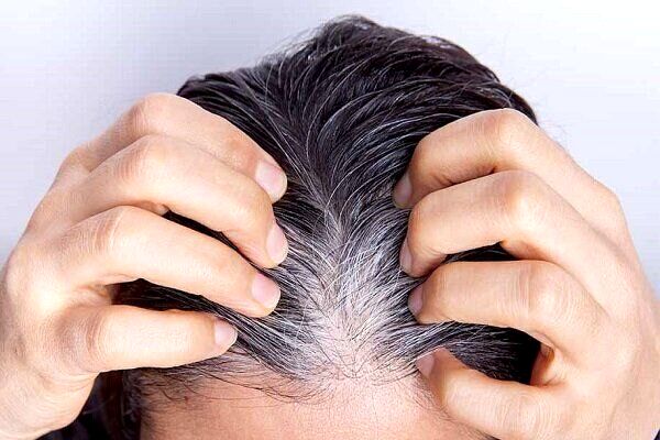 یافته‌ای جدید درباره سفید شدن مو
