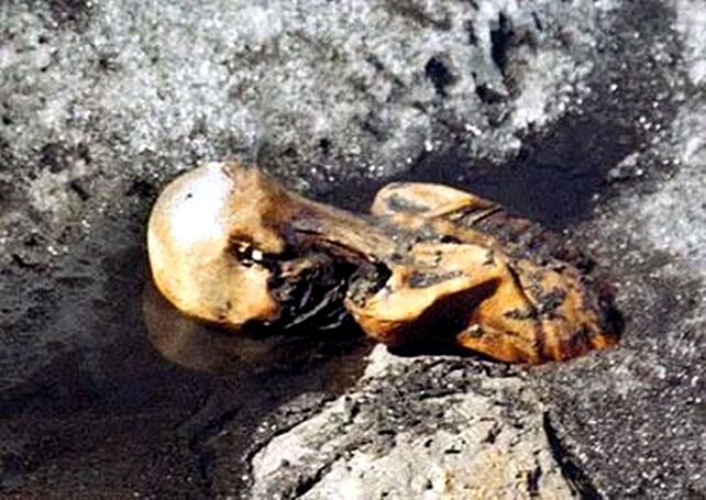 کشف نشانه‌هایی از حیات در مرد یخی!