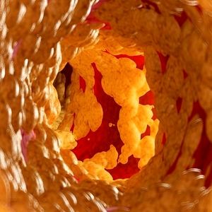 کاهش ۵۸ درصدی کلسترول بد با یک داروی جدید