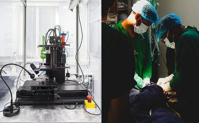 کوچک‌ترین چاپگر زیستی ۳ بُعدی جهان، ناجی تارهای صوتی می‌شود