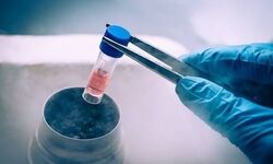انجماد تخمک؛ راهی برای حفظ شانس باروری دختران مبتلا به سرطان