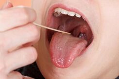 نقش لوزه‌ها در سیستم ایمنی بدن