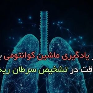 استفاده از یادگیری ماشین کوانتومی برای بهبود دقت در تشخیص سرطان ریه