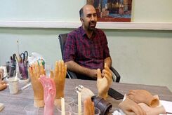 ماجرای تولید دست الکترونیکی در ایران که از یک قطع عضو شروع شد