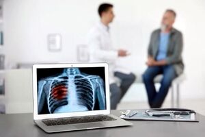پرتودرمانی، جایگزینی قوی برای جراحی در سرطان ریه 
