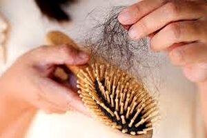اختراع جالب برای کاهش ۹۲ درصدی ریزش مو 