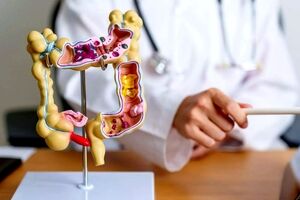 نتایج یک پژوهش جدید؛ افراد مبتلا به سرطان روده چگونه می‌توانند مانند افراد عادی عمر کنند؟