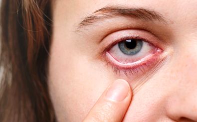 بلاهایی که آلودگی هوا بر سر چشم‌ها می‌آورد 