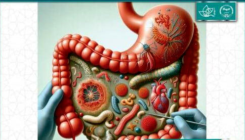 ارزیابی جمعیت باکتری‌ها در بیماران مبتلا به گاستریت و آتروفی معده